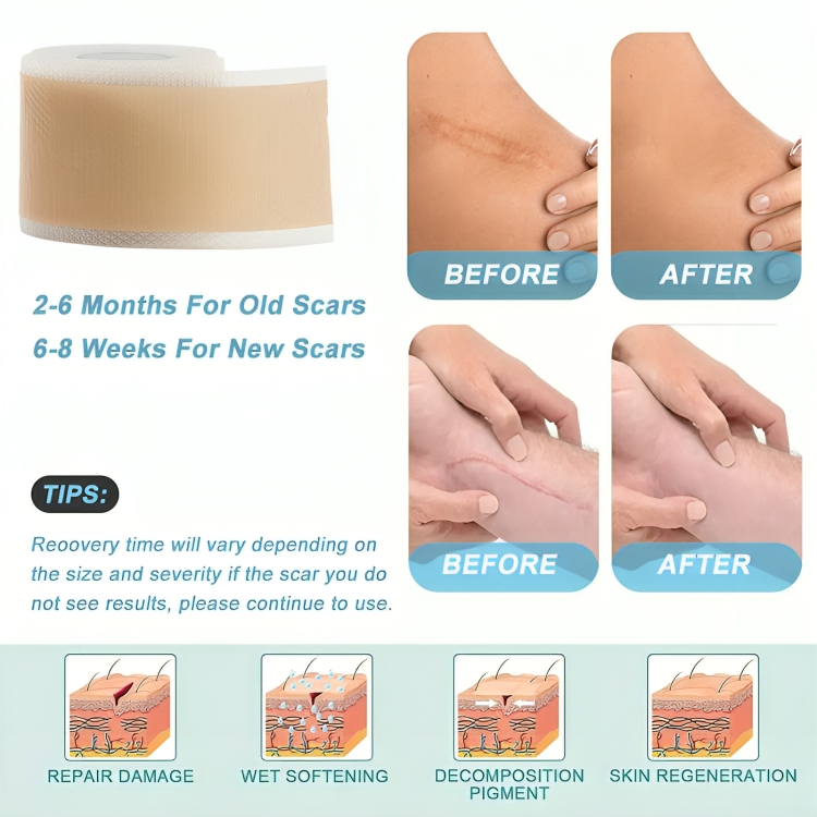 SkinTape™ – Verblassen Sie Narben und Falten und gewinnen Sie Ihr Selbstvertrauen zurück! | 1+1 GRATIS