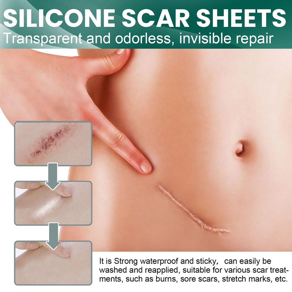 SkinTape™ – Verblassen Sie Narben und Falten und gewinnen Sie Ihr Selbstvertrauen zurück! | 1+1 GRATIS